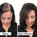 Hair Renew