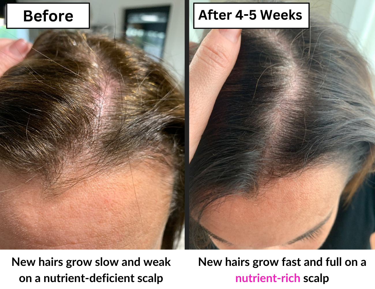 Hair Renew